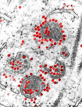 Eastern Equine Encephalitis Virus, TEM