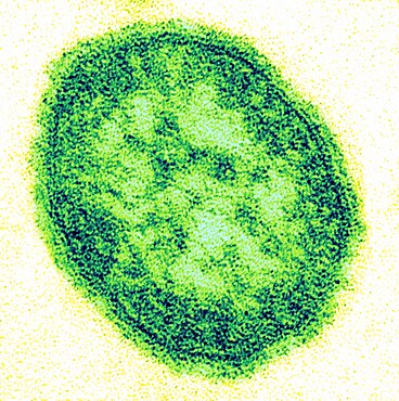 MeV, Measles Virus, TEM