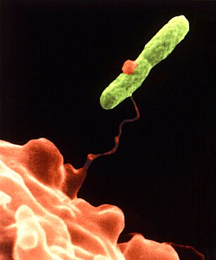 Entrapped Legionella pneumophila Bacterium, SEM