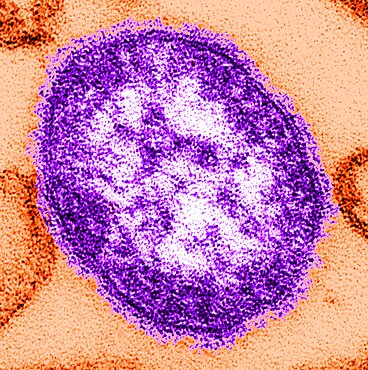 Measles Virus, TEM