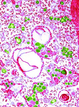 Group C RNA Tumor Virus, TEM