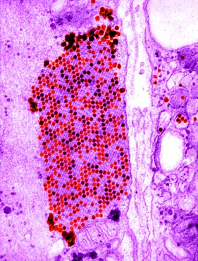 Coxsackie B3 Virus, TEM