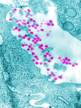 Rubella Virus, German Measles, TEM