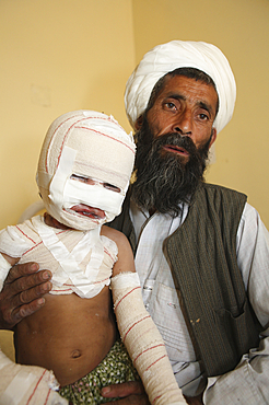 burn victims of a IED attack in Afghanistan