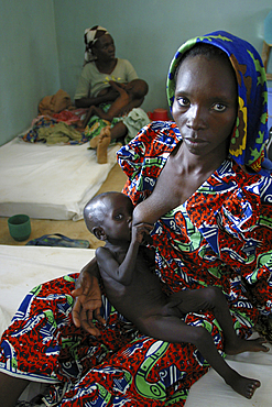 malnourished child in a clinic during the famine in 2008, nigeria