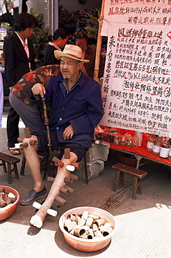 Maxibustion medical treatment, Guizhou, China, Asia