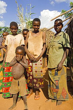 Burundi, Cibitoke Province, Kirundo, A family beside the road living in poverty child with obvious worms.