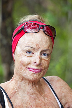 A lady who was horribly burned in a house fire and who now work for the Peter Hughes Burn Foundation providing counselling and support for the victims of bush fires, Australia, Pacific